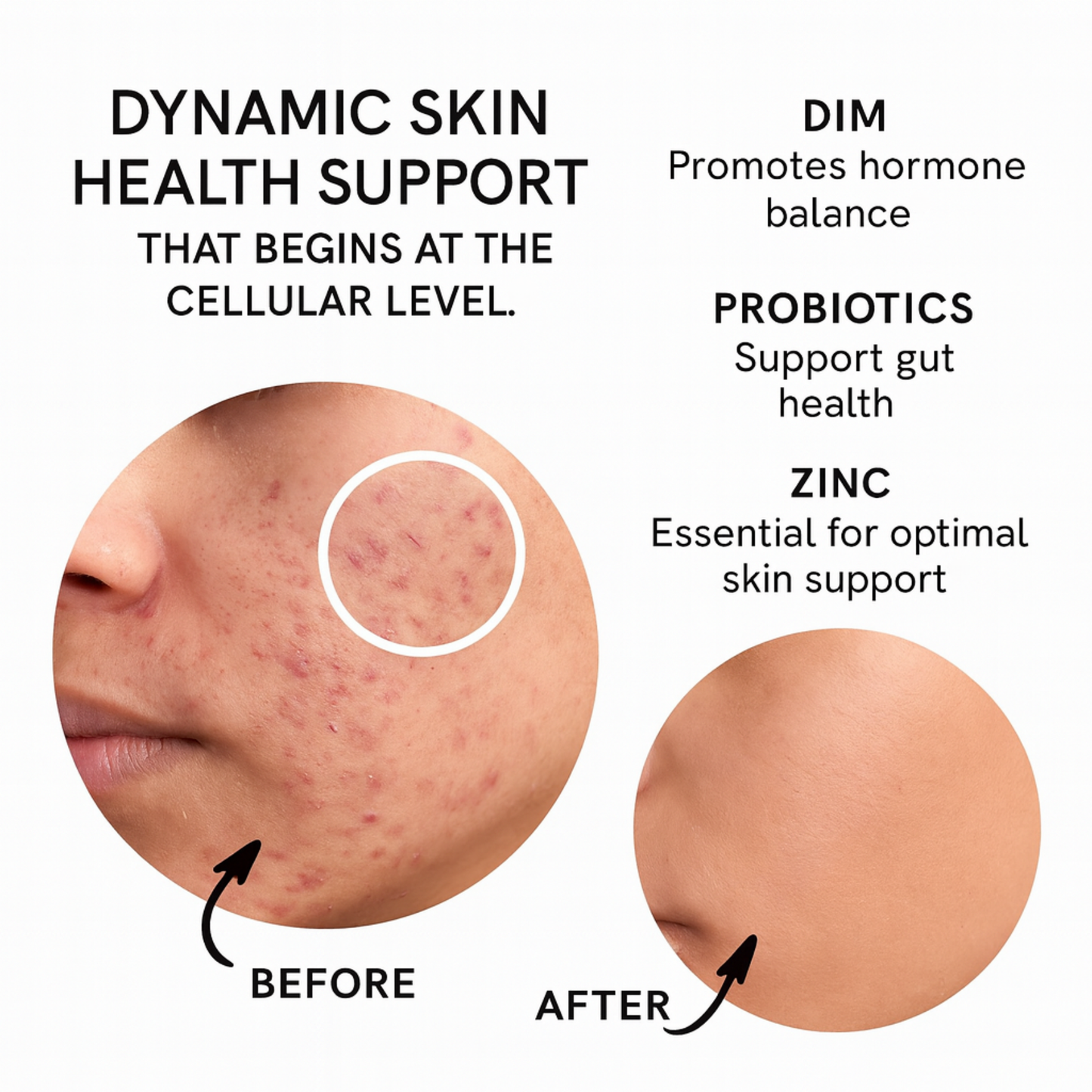 Lumi Clear Skin Support
