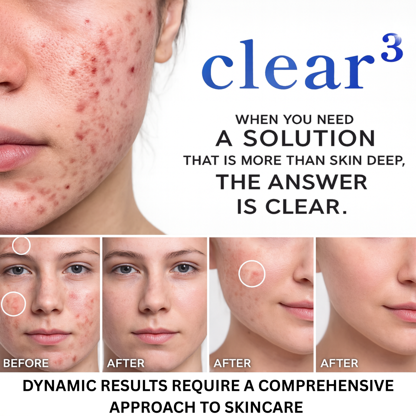 Lumi Clear Skin Support
